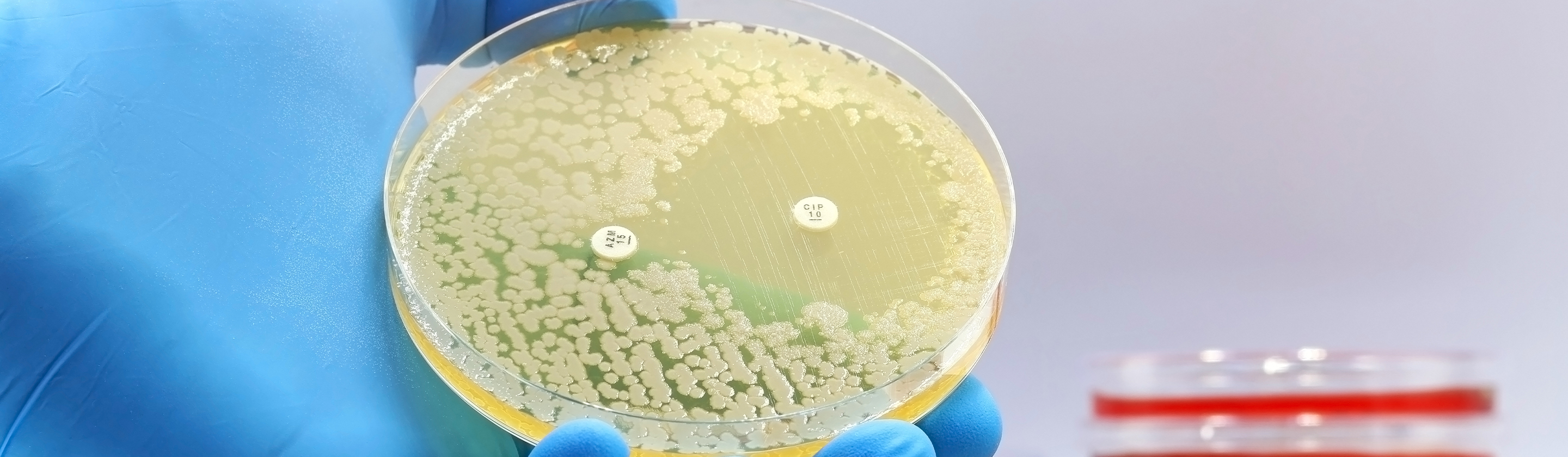 QPS Microorganisms : A Safe Approach to Innovative Food